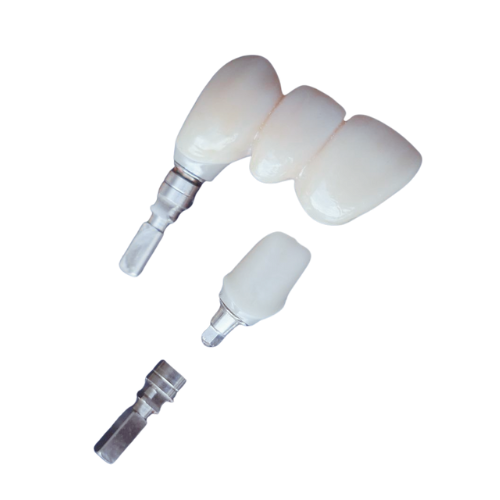 Implantate